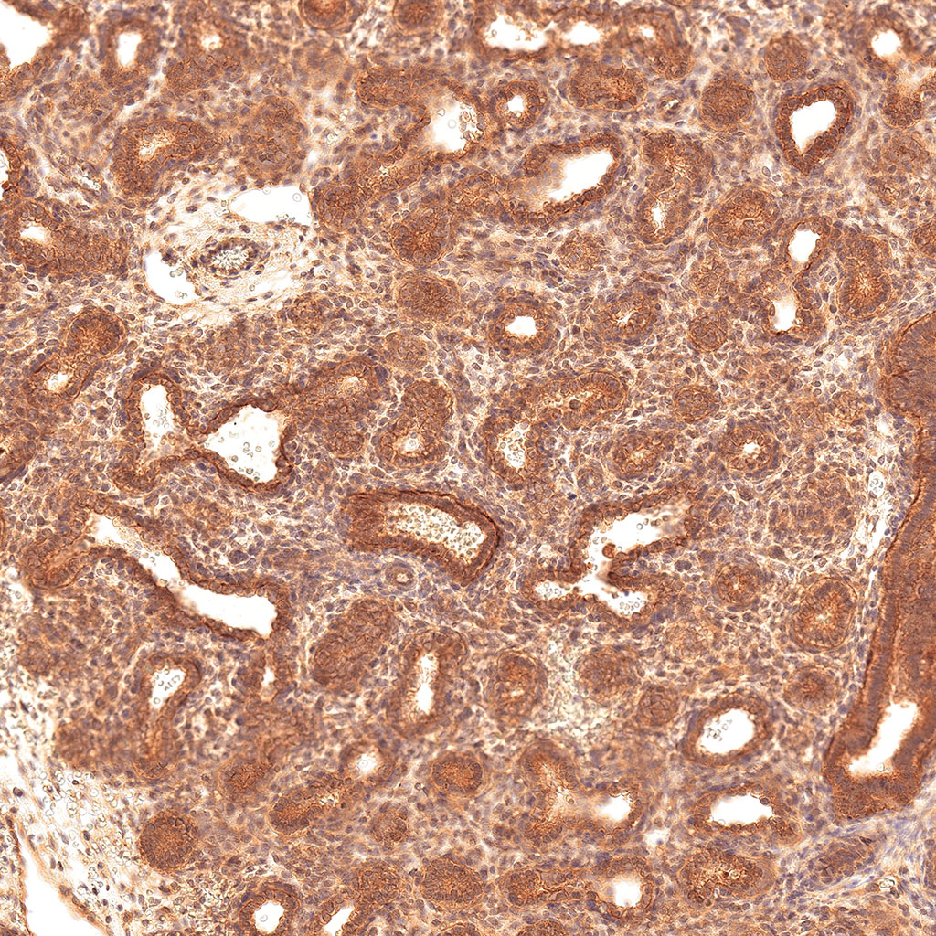sars-cov-2 gene expression in a human fetus
